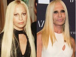 5 Potret Seleb Gagal Oplas, Wajah Cantiknya Malah Berubah Jadi Seperti Ini