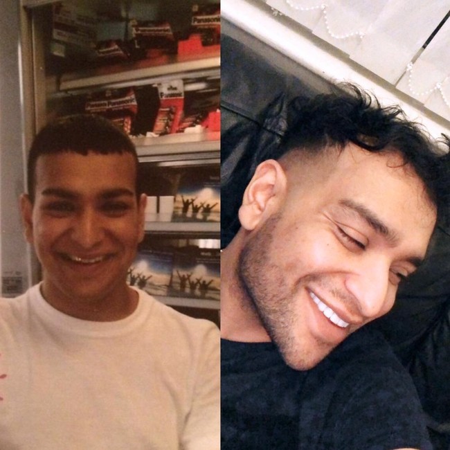 Seperti dikutip dari Mirror, sebelumnya Aneece merasa tidak puas dengan wajahnya. Dia selalu menggunakan filter sebelum mengunggah foto atau video-videonya di media sosial. Foto: Instagram/@aneece111