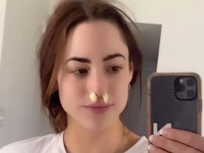 Redakan Sinus Pakai Bawang Putih Redakan Sinus Pakai Bawang Putih