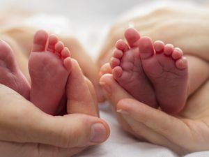 Kasus Langka Ditemukan Lagi, Seorang Bayi Mengandung Kembarannya Sendiri