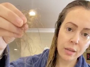 Rambut Rontok Setelah Sembuh Covid-19, Penyebab Dan Cara Mengatasinya