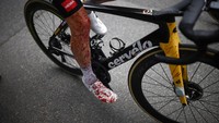 Cipratan darah terlihat di kaki pebalap Belanda, Steven Kruijswijk saat kecelakaan di etape ketiga (28/6/2021). Supremasi tertinggi Tour de France  membuat pemain bersemangat dan ngotot untuk menjadi yang terdepan. AP/Stephane Mahe