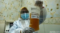 Sebelum menjadi pendonor, penyintas COVID-19 harus menjalani skrining terlebih dahulu.