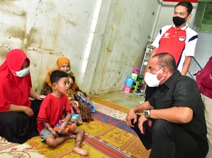 2 Anak Derita Sakit Kulit Misterius, Gubsu Janji Biayai Sampai Sembuh