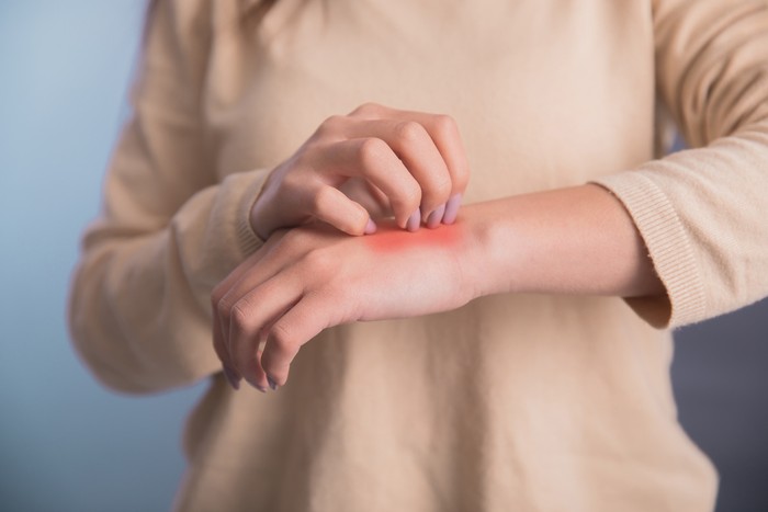 Woman scratch the itch with hand