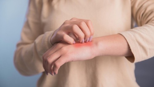 Woman scratch the itch with hand