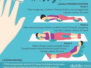 Dokter Paru RSA UGM: Pasien Sesak Napas Butuh Proning dan Oksigen