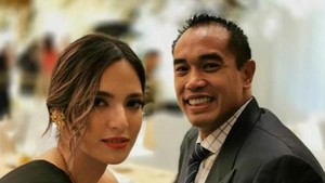 Ini Kondisi Ardi Bakrie Setelah Kecelakaan dan Kepala Terbentur Lantai
