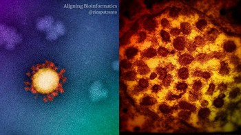 Nah ini adalah virus Corona varian Delta. Foto: Tangkapan layar The Peter Doherty Institute for Infection