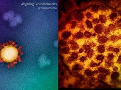 Foto Benda-benda di Sekitar Dilihat dari Mikroskop, Menakjubkan!