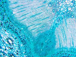 Foto Benda-benda di Sekitar Dilihat dari Mikroskop, Menakjubkan!