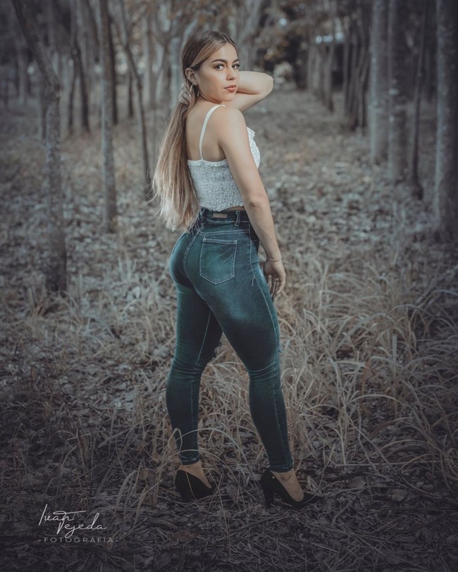 Sebelum datang ke klinik yang meng-endorse-nya, Odalis Santos Mena sempat menyebutkan bahwa prosedur tersebut aman dan efektif kepada para follower. Foto: Instagram @odalis_sm