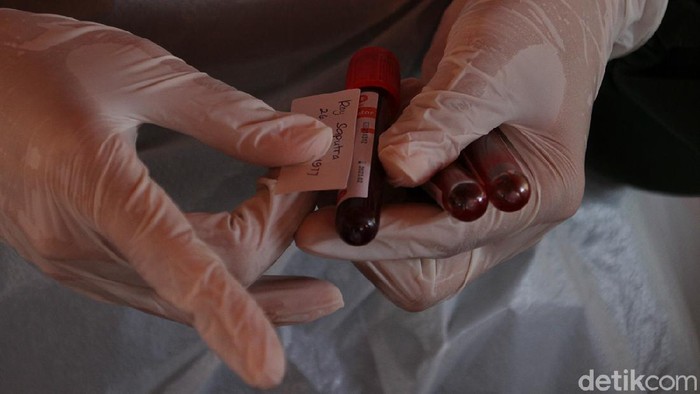 Aksi Donor Plasma Konvalesen di Solo Sejumlah penyintas COVID-19 di Solo ikut serta dalam aksi donor plasma konvalesen. Kegiatan itu dilakukan untuk bantu ketersediaan stok plasma konvalesen PMI.