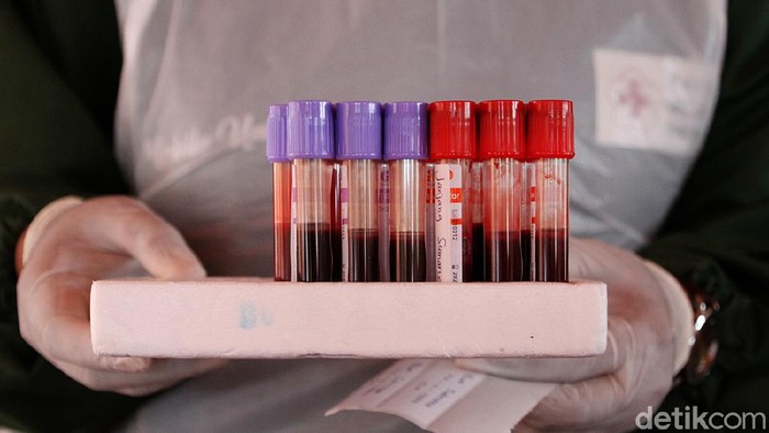Aksi Donor Plasma Konvalesen di Solo Sejumlah penyintas COVID-19 di Solo ikut serta dalam aksi donor plasma konvalesen. Kegiatan itu dilakukan untuk bantu ketersediaan stok plasma konvalesen PMI.