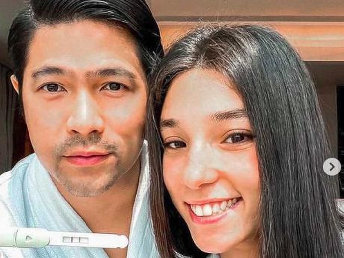 Erick Iskandar dan Vanessa Lima umumkan kehamilan