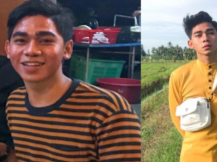 Transformasi wajah pria jerawatan viral Transformasi wajah pria jerawatan viral
