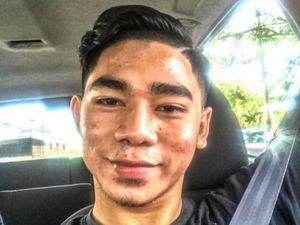 Dulu Dibully Wajah bak Jalanan Rusak, Transformasi Pria Ini Bikin Terkejut