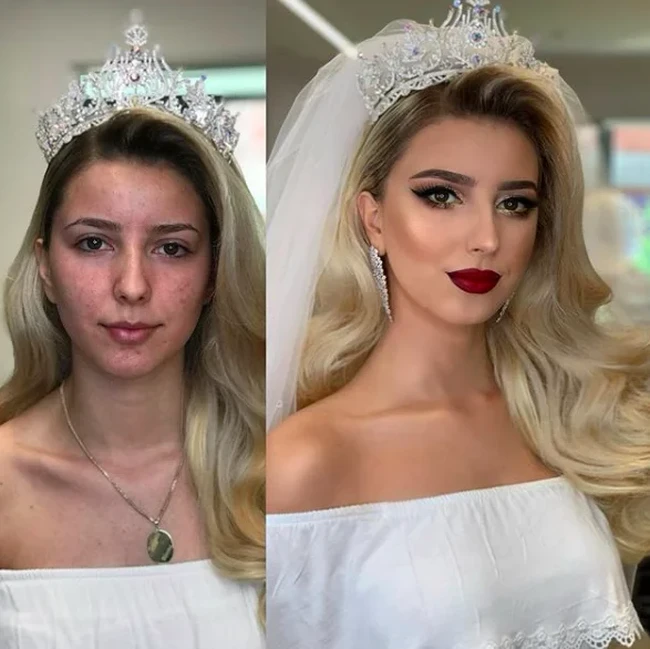 Wanita ini seperti menjadi orang yang berbeda di hari pernikahannya. Wajahnya tampak flawless, tak terlihat bercak-bercak seperti di foto sebelum makeup. Foto: Dok. Instagram @arber_bytyqi_mua