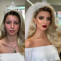 Wanita ini seperti menjadi orang yang berbeda di hari pernikahannya. Wajahnya tampak flawless, tak terlihat bercak-bercak seperti di foto sebelum makeup. Foto: Dok. Instagram @arber_bytyqi_mua