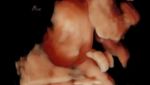 Potret Kehamilan Nagita Slavina, Hasil USG Mancung Mirip Raffi Ahmad