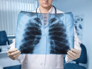 Tanda Paru-paru Sudah Kotor, Dokter Minta Waspadai Bunyi Napas Seperti Ini