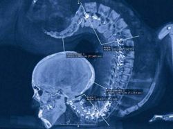 Merinding! Ini Bukti Perjuangan Pahlawan Olahraga Harumkan Nama Bangsa