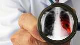 5 Cara Detoks Paru-paru Alami yang Disarankan Ahli, Patut Dicoba