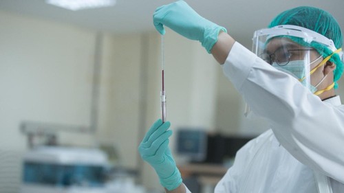 Prodia menyediakan pemeriksaan kesehatan yang mampu memprediksi risiko gangguan saraf berdasarkan profil genetik seseorang atau disebut NEUROgenomics. NEUROgenomics merupakan pemeriksaan genomik yang digunakan untuk mengidentifikasi kerentanan genetik seseorang terhadap penyakit yang berkaitan dengan gangguan saraf seperti penyakit Alzheimer, Sklerosis Lateral Amiotrofik, Gangguan, Bipolar, Epilepsi, Aneurisma intrakranial, Migrain, Sklerosis, Ganda, Parkinson, Skizofrenia, dan Stroke. Pemeriksaan ini menganalisis lebih dari 109 varian dan 85 gen.