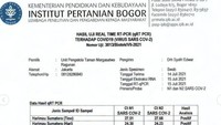 Ini hasli PCR Hari dan Tino.