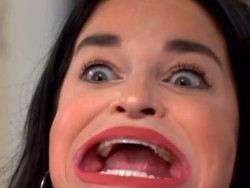 Foto: Penampakan Pemilik Bibir Terbesar, Dulu Insecure Kini Pecahkan Rekor