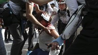 Kericuhan yang terjadi menyebabkan sejumlah demonstran terluka. AP Photo/Adrienne Surprenant.