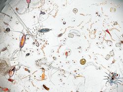 Mencengangkan! Foto Bagian Tubuh & Benda  Sekitar Dilihat dari Mikroskop