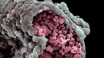 Arteri dan sel darah merah. Foto: dok Twitter/PostMindBlowing