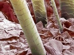 Mencengangkan! Foto Bagian Tubuh & Benda  Sekitar Dilihat dari Mikroskop