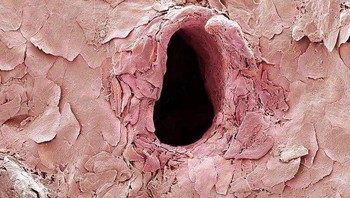 Lubang di kulit setelah ditusuk oleh jarum suntik. Foto: dok Twitter/PostMindBlowing