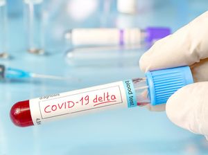 Penjelasan Satgas Covid-19 Terkait Beda Variant of Concern dan Interest