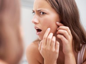 7 Cara Menghilangkan Bekas Jerawat, Dijamin Mantul!