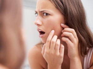 7 Cara Menghilangkan Bekas Jerawat, Dijamin Mantul!