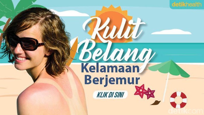 6 Cara Samarkan Kulit Belang akibat Kelamaan Berjemur