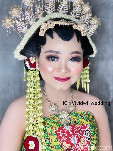 Jelang pernikahan, wajah pengantin ini penuh luka dan sukses bikin pangling saat hari pernikahan.