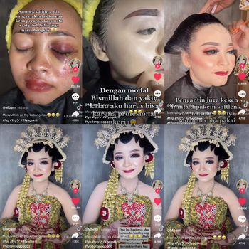 Jelang pernikahan, wajah pengantin ini penuh luka dan sukses bikin pangling saat hari pernikahan.