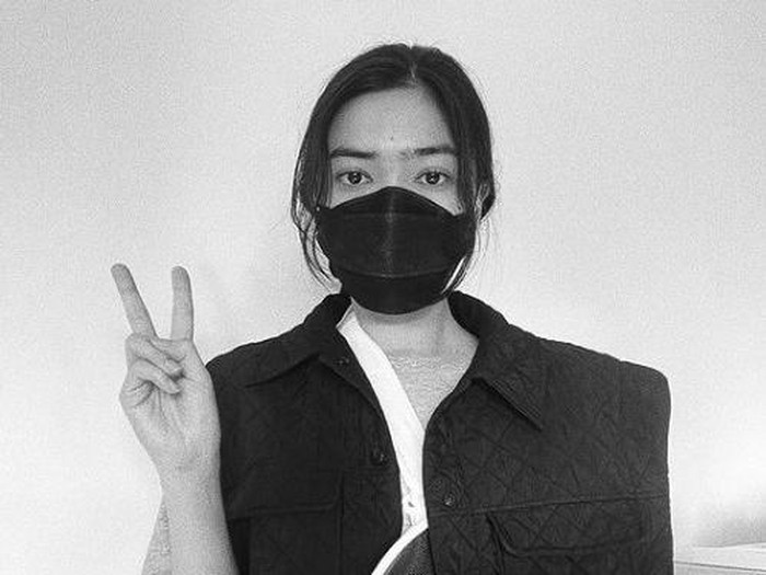 kenapa dengan jari Isyana Sarasvati?