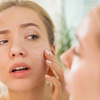 Kulit Masih Kering Meski Pakai Moisturizer? Ternyata Ini 9 Penyebabnya