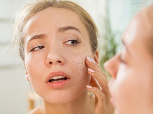 Kulit Masih Kering Meski Pakai Moisturizer? Ternyata Ini 9 Penyebabnya