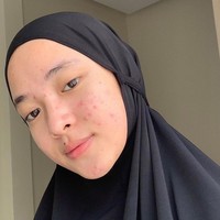 Nissa Sabyan juga berani menunjukkan wajah tanpa makeup. Kala itu, wajah Nisa tengah berjerawat. Penampilannya itu mendapatkan banyak hujatan netizen.Foto: dok. Instagram/@nissa_sabyan