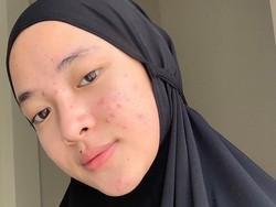 10 Wajah Asli Artis Indonesia Tanpa Makeup, Penampilan Nissa Sabyan Bikin Kaget