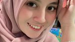 Artis Wanita yang Punya Gigi Gingsul, Senyumnya Manis Banget!