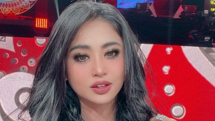 Menyoal Operasi Kelopak Mata Dewi Persik, Masih Bengkak gegara Ini