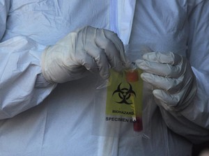 Eks Petinggi WHO Sebut Tak Mustahil Omicron Sudah Masuk RI, Ini Cirinya