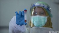 Presiden Joko Widodo (Jokowi) memerintahkan agar harga tes polymerase chain reaction (PCR) diturunkan kemarin. Jokowi meminta agar biaya tes PCR di kisaran Rp 450-550 ribu. Bagaimana di lapangan?